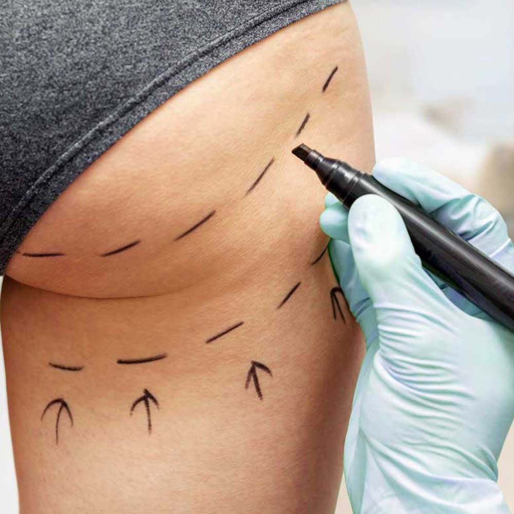 Klinik estetik tedavi